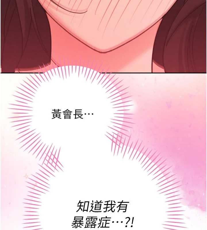 暴君會長的嬌媳們第47話-她的暴露症